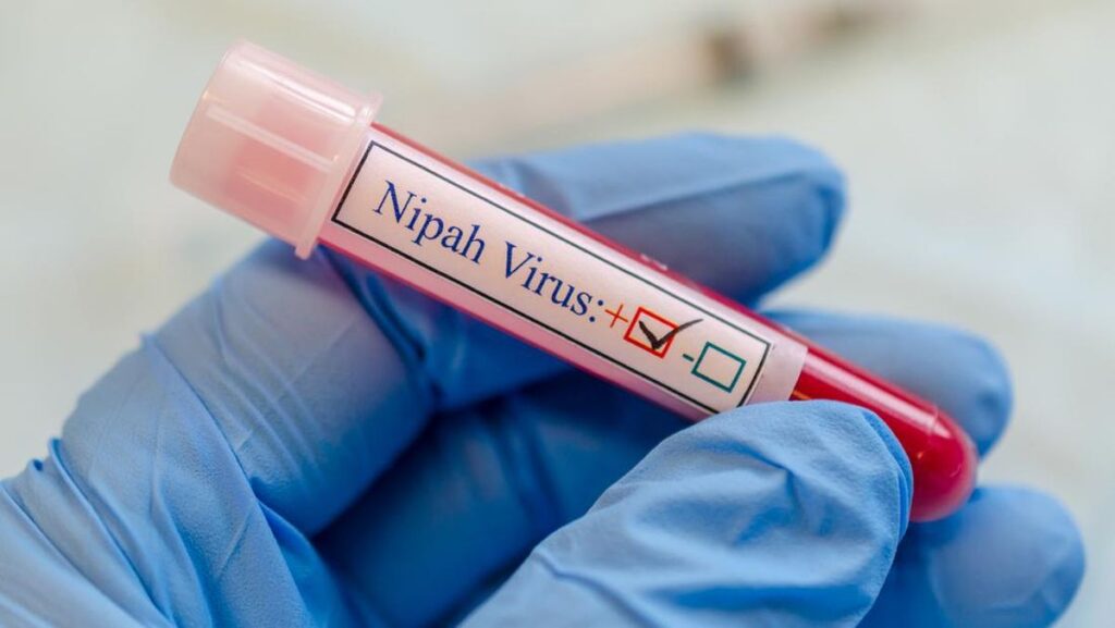 Bali Nipah Virus : Stay Informed about Nipah Virus in Bali & Recognize the Symptoms